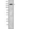 Chromodomain Helicase DNA Binding Protein 2 antibody, abx149279, Abbexa, Western Blot image 