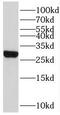 Mitochondrial Ribosomal Protein L47 antibody, FNab05335, FineTest, Western Blot image 