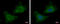 Rab Geranylgeranyltransferase Subunit Beta antibody, GTX105874, GeneTex, Immunofluorescence image 