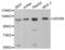 DExD/H-Box Helicase 58 antibody, abx000755, Abbexa, Western Blot image 