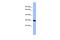 Methyltransferase Like 5 antibody, PA5-70061, Invitrogen Antibodies, Western Blot image 