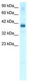 TSC22 Domain Family Member 4 antibody, TA329117, Origene, Western Blot image 