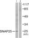 Synaptosome Associated Protein 25 antibody, abx013194, Abbexa, Western Blot image 