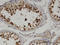 Cytoskeleton Associated Protein 2 antibody, LS-C134059, Lifespan Biosciences, Immunohistochemistry paraffin image 