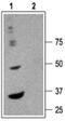 Gamma-Aminobutyric Acid Type A Receptor Alpha6 Subunit antibody, PA5-77403, Invitrogen Antibodies, Western Blot image 