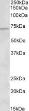 Acyl-CoA Dehydrogenase Very Long Chain antibody, LS-C186632, Lifespan Biosciences, Western Blot image 