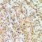Insulin Like Growth Factor 2 MRNA Binding Protein 3 antibody, LS-C668277, Lifespan Biosciences, Immunohistochemistry paraffin image 