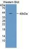 Aminolevulinate Dehydratase antibody, abx128356, Abbexa, Western Blot image 