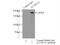 Terminal Uridylyl Transferase 4 antibody, 18980-1-AP, Proteintech Group, Immunoprecipitation image 