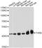 Thyroid Hormone Receptor Beta antibody, A1582, ABclonal Technology, Western Blot image 