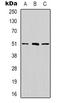 Ribosomal RNA Processing 8 antibody, LS-C368896, Lifespan Biosciences, Western Blot image 