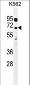 Leucine Rich Repeat Containing 63 antibody, LS-C203677, Lifespan Biosciences, Western Blot image 