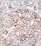 Phosphoinositide-3-Kinase Regulatory Subunit 4 antibody, GTX25459, GeneTex, Immunohistochemistry paraffin image 