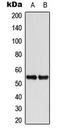 Keratin 8 antibody, LS-C354020, Lifespan Biosciences, Western Blot image 