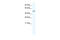 Tetratricopeptide Repeat Domain 19 antibody, 28-664, ProSci, Enzyme Linked Immunosorbent Assay image 