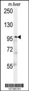 Kinesin Family Member 9 antibody, 62-114, ProSci, Western Blot image 