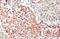 MDM2 Proto-Oncogene antibody, GTX100531, GeneTex, Immunohistochemistry paraffin image 
