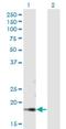 DBF4 Zinc Finger B antibody, H00080174-B01P, Novus Biologicals, Western Blot image 