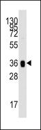 Aldolase, Fructose-Bisphosphate A antibody, PA5-12302, Invitrogen Antibodies, Western Blot image 