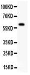 TNF Receptor Superfamily Member 25 antibody, PA2004, Boster Biological Technology, Western Blot image 