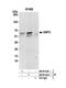 Glucose-6-Phosphate Dehydrogenase antibody, NB100-236, Novus Biologicals, Western Blot image 