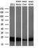 Zinc Ribbon Domain Containing 2 antibody, MA5-25288, Invitrogen Antibodies, Western Blot image 