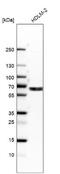 EGF Domain Specific O-Linked N-Acetylglucosamine Transferase antibody, NBP1-90224, Novus Biologicals, Western Blot image 