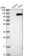 VPS41 Subunit Of HOPS Complex antibody, PA5-54138, Invitrogen Antibodies, Western Blot image 