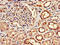 Cleavage And Polyadenylation Specific Factor 6 antibody, LS-C670466, Lifespan Biosciences, Immunohistochemistry paraffin image 