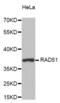 RAD51 Recombinase antibody, abx004788, Abbexa, Western Blot image 