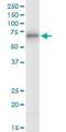 Arginyltransferase 1 antibody, H00011101-M01, Novus Biologicals, Western Blot image 