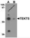 Tektin 5 antibody, 6383, ProSci Inc, Western Blot image 