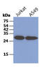 Tubulin Folding Cofactor B antibody, AM50094PU-S, Origene, Western Blot image 
