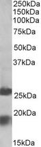 Dynactin Subunit 3 antibody, 42-682, ProSci, Western Blot image 