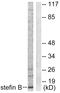 Cystatin-beta antibody, LS-C118581, Lifespan Biosciences, Western Blot image 