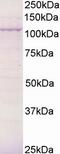 BCAR3 Adaptor Protein, NSP Family Member antibody, EB05071, Everest Biotech, Western Blot image 