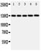 Prominin-1 antibody, PA2063, Boster Biological Technology, Western Blot image 