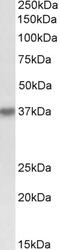 Defective In Cullin Neddylation 1 Domain Containing 1 antibody, 42-547, ProSci, Enzyme Linked Immunosorbent Assay image 