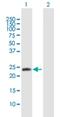 N-Terminal Xaa-Pro-Lys N-Methyltransferase 1 antibody, H00028989-B01P, Novus Biologicals, Western Blot image 