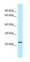 Relaxin 2 antibody, NBP1-98451, Novus Biologicals, Western Blot image 