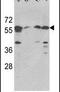 Serine Palmitoyltransferase Long Chain Base Subunit 1 antibody, PA5-12220, Invitrogen Antibodies, Western Blot image 