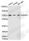 SUMO Specific Peptidase 1 antibody, A1260, ABclonal Technology, Western Blot image 