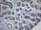 O-6-Methylguanine-DNA Methyltransferase antibody, LS-C175455, Lifespan Biosciences, Immunohistochemistry frozen image 