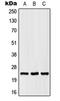 Sodium Voltage-Gated Channel Beta Subunit 2 antibody, LS-C352816, Lifespan Biosciences, Western Blot image 