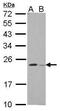 Glutathione Peroxidase 8 (Putative) antibody, PA5-34917, Invitrogen Antibodies, Western Blot image 