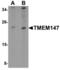 Transmembrane Protein 147 antibody, LS-B9558, Lifespan Biosciences, Western Blot image 