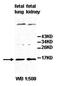 Interleukin 25 antibody, orb77822, Biorbyt, Western Blot image 