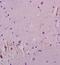 Transforming Growth Factor Beta Receptor 1 antibody, orb11472, Biorbyt, Immunohistochemistry paraffin image 