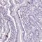 Zinc Finger Protein 334 antibody, NBP2-13567, Novus Biologicals, Immunohistochemistry frozen image 