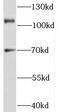 Testis Expressed 11 antibody, FNab08606, FineTest, Western Blot image 